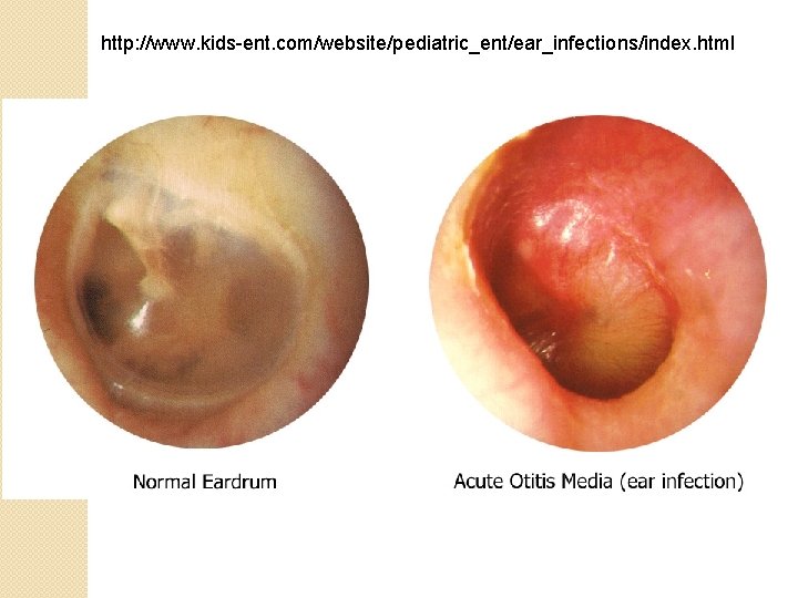 http: //www. kids-ent. com/website/pediatric_ent/ear_infections/index. html 