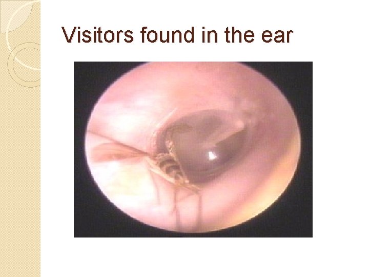 Visitors found in the ear 