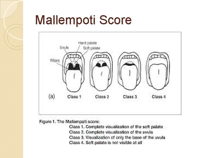 Mallempoti Score 