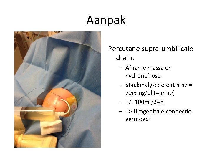 Aanpak Percutane supra-umbilicale drain: – Afname massa en hydronefrose – Staalanalyse: creatinine = 7,