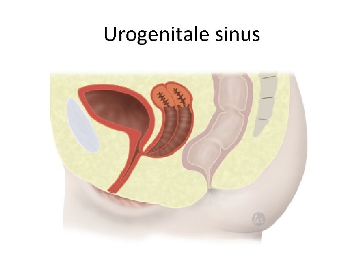 Urogenitale sinus 