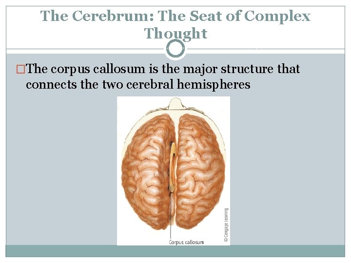 The Cerebrum: The Seat of Complex Thought �The corpus callosum is the major structure