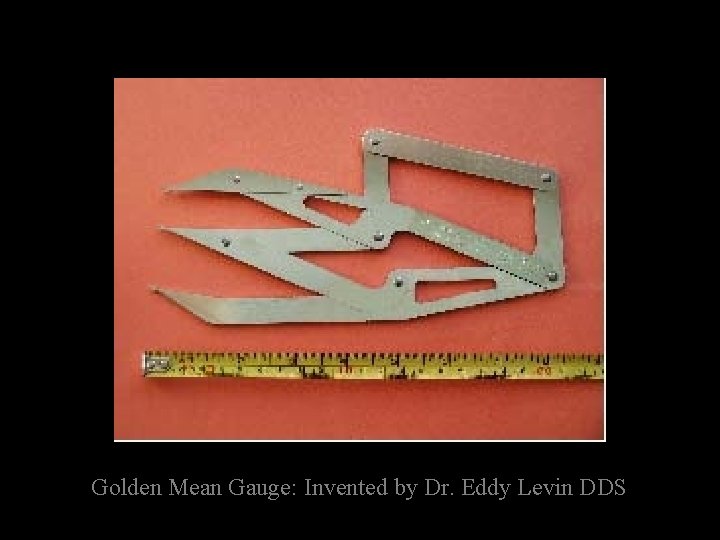 Golden Mean Gauge: Invented by Dr. Eddy Levin DDS 