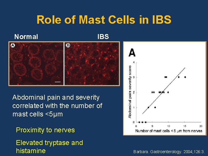 Role of Mast Cells in IBS Normal IBS Abdominal pain and severity correlated with