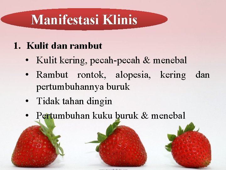 Manifestasi Klinis 1. Kulit dan rambut • Kulit kering, pecah-pecah & menebal • Rambut