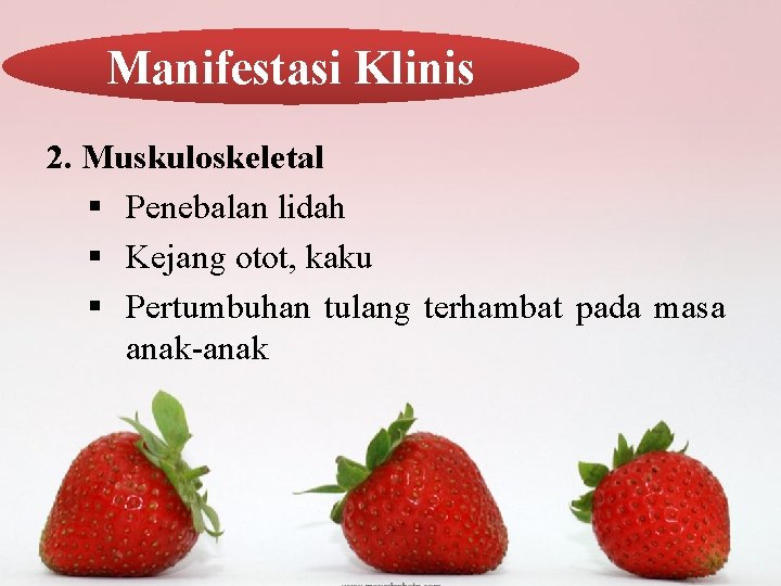 Manifestasi Klinis 2. Muskuloskeletal § Penebalan lidah § Kejang otot, kaku § Pertumbuhan tulang