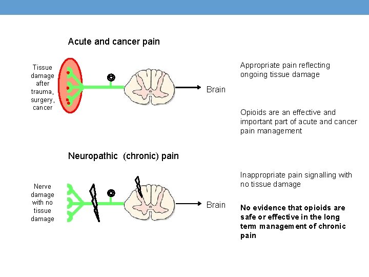 Acute and cancer pain Appropriate pain reflecting ongoing tissue damage Tissue damage after trauma,
