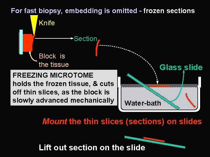 For fast biopsy, embedding is omitted - frozen sections Knife Section Block is the