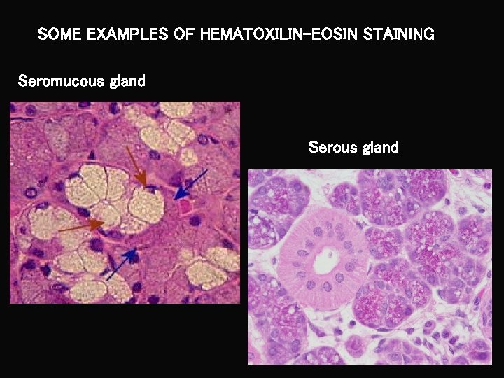 SOME EXAMPLES OF HEMATOXILIN-EOSIN STAINING Seromucous gland Serous gland 