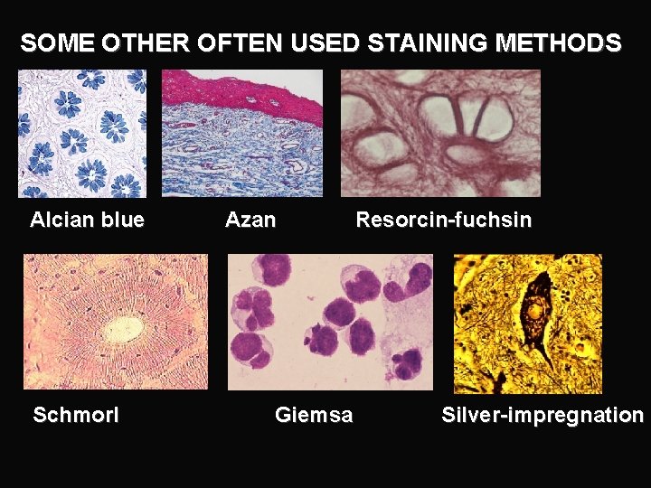 SOME OTHER OFTEN USED STAINING METHODS Alcian blue Schmorl Azan Giemsa Resorcin-fuchsin Silver-impregnation 
