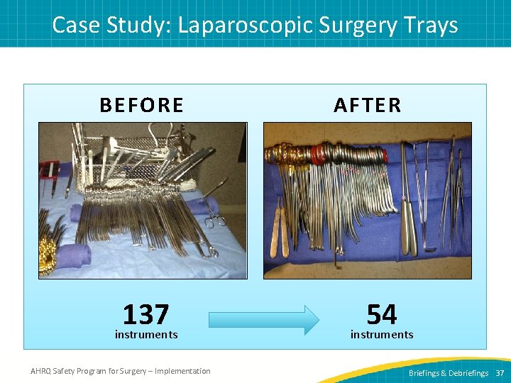 Case Study: Laparoscopic Surgery Trays BEFORE 137 instruments AHRQ Safety Program for Surgery –