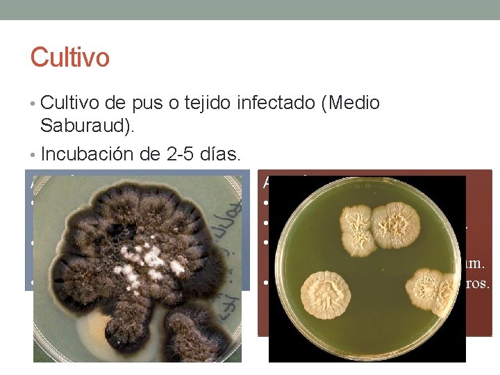 Cultivo • Cultivo de pus o tejido infectado (Medio Saburaud). • Incubación de 2