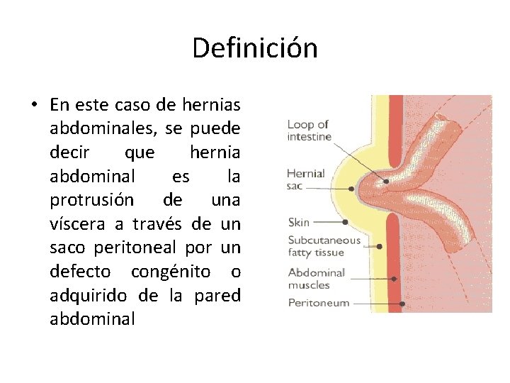 Definición • En este caso de hernias abdominales, se puede decir que hernia abdominal