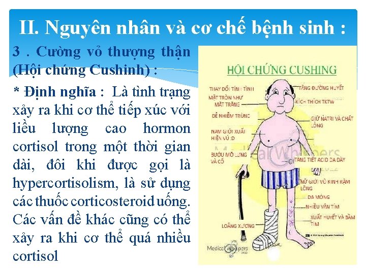 II. Nguyên nhân và cơ chế bệnh sinh : 3. Cường vỏ thượng thận