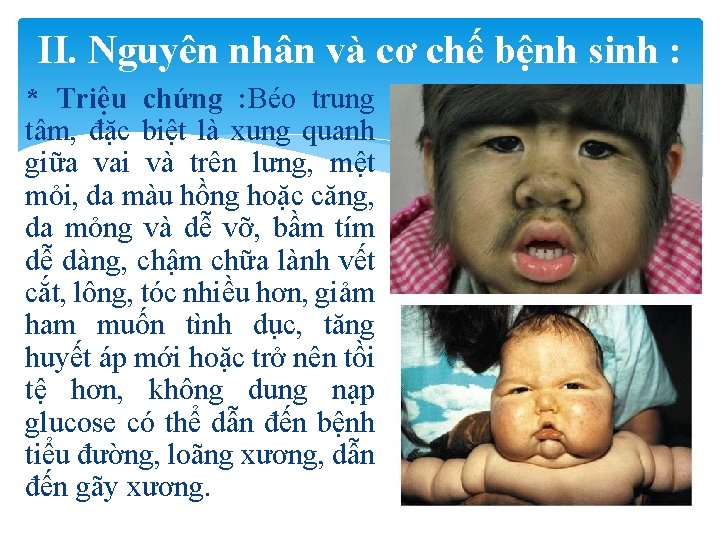 II. Nguyên nhân và cơ chế bệnh sinh : * Triệu chứng : Béo