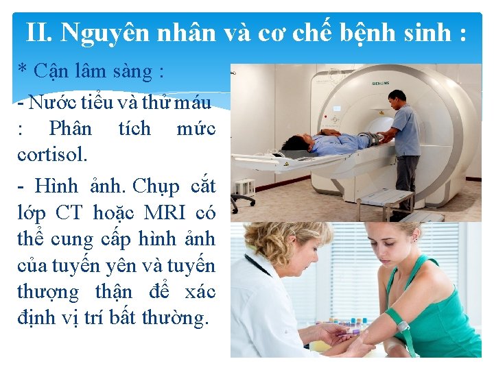 II. Nguyên nhân và cơ chế bệnh sinh : * Cận lâm sàng :