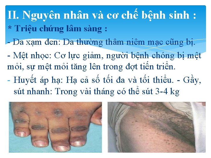 II. Nguyên nhân và cơ chế bệnh sinh : * Triệu chứng lâm sàng