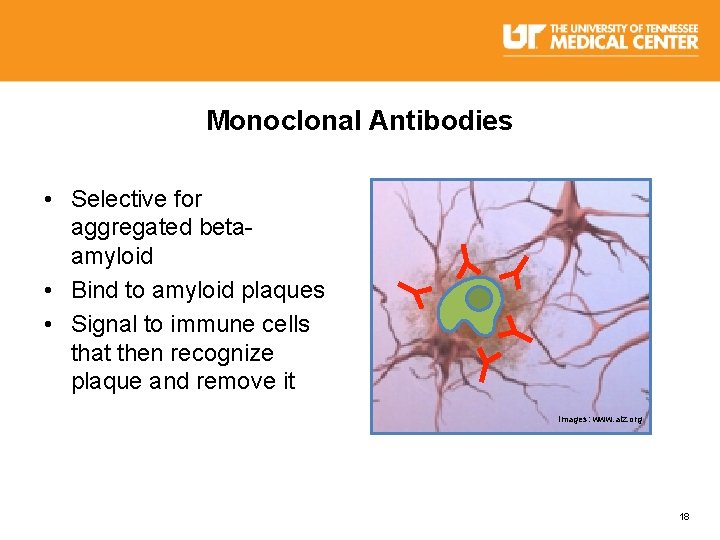Monoclonal Antibodies • Selective for aggregated betaamyloid • Bind to amyloid plaques • Signal