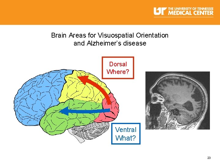 Brain Areas for Visuospatial Orientation and Alzheimer’s disease Dorsal Where? Ventral What? 23 