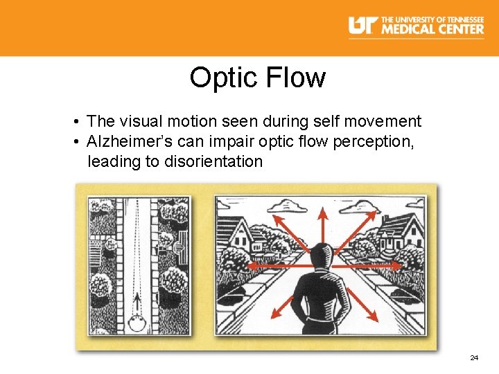 Optic Flow • The visual motion seen during self movement • Alzheimer’s can impair