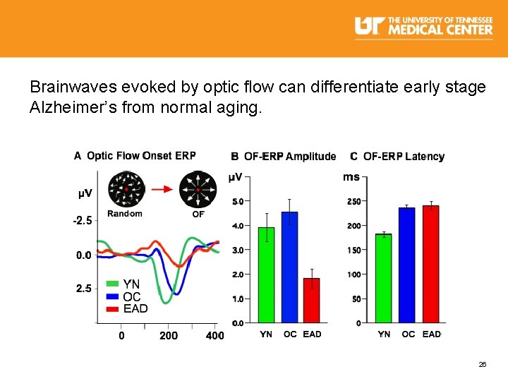 Brainwaves evoked by optic flow can differentiate early stage Alzheimer’s from normal aging. 26