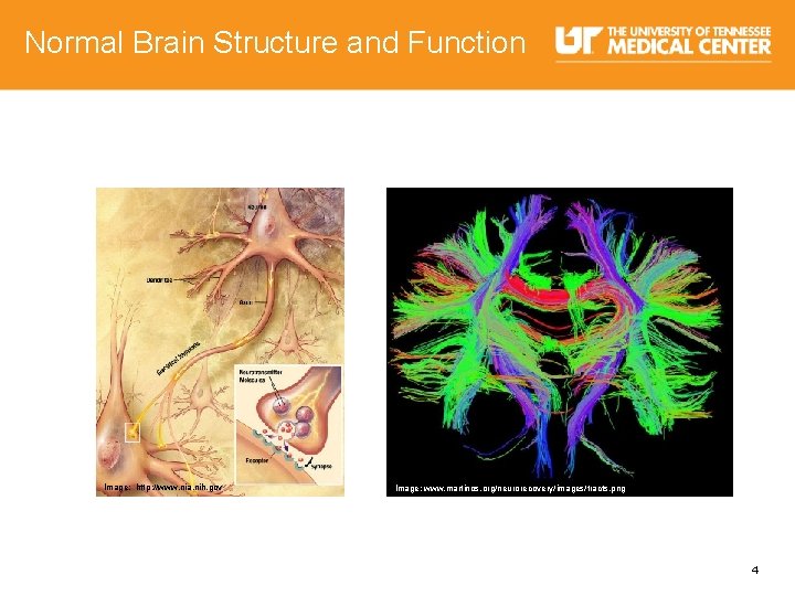 Normal Brain Structure and Function Image: http: //www. nia. nih. gov Image: www. martinos.
