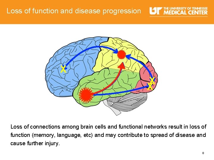 Loss of function and disease progression X X X Loss of connections among brain