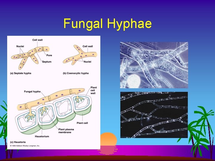 Fungal Hyphae 