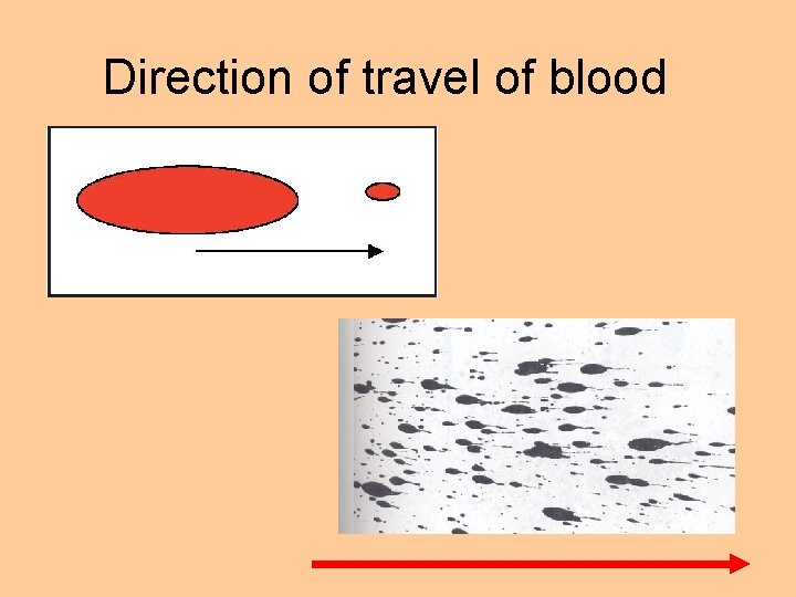 Direction of travel of blood 