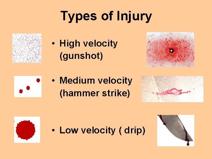 Types of Injury • High velocity (gunshot) • Medium velocity (hammer strike) • Low