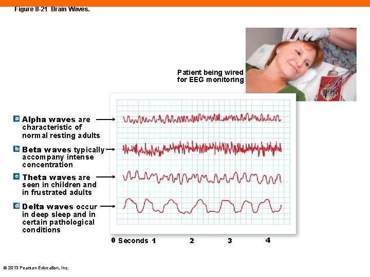 Figure 8 -21 Brain Waves. Patient being wired for EEG monitoring Alpha waves are