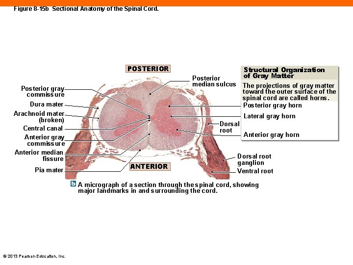 Figure 8 -15 b Sectional Anatomy of the Spinal Cord. POSTERIOR Posterior median sulcus