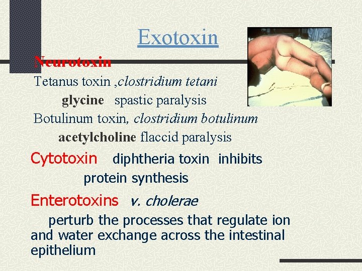 Exotoxin Neurotoxin Tetanus toxin , clostridium tetani glycine spastic paralysis Botulinum toxin, clostridium botulinum