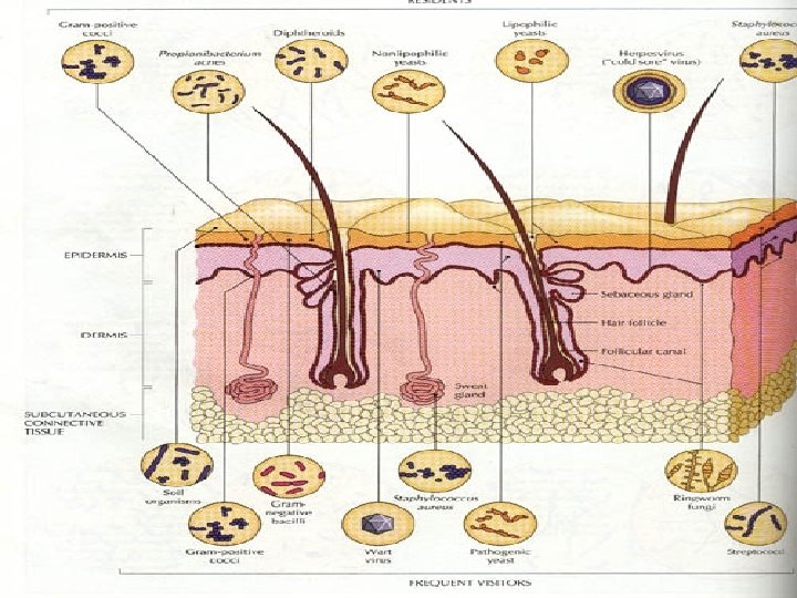 Normal flora Skin Staphylococcus epidermidis Diphtheroids Streptococci Peptococcus 