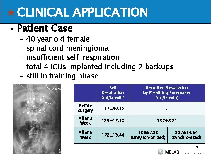 CLINICAL APPLICATION • Patient Case – – – 40 year old female spinal cord