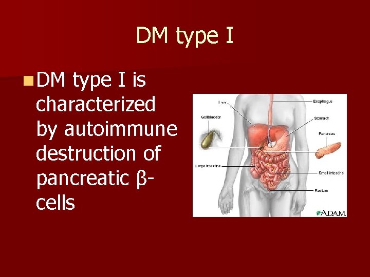 DM type I n DM type I is characterized by autoimmune destruction of pancreatic