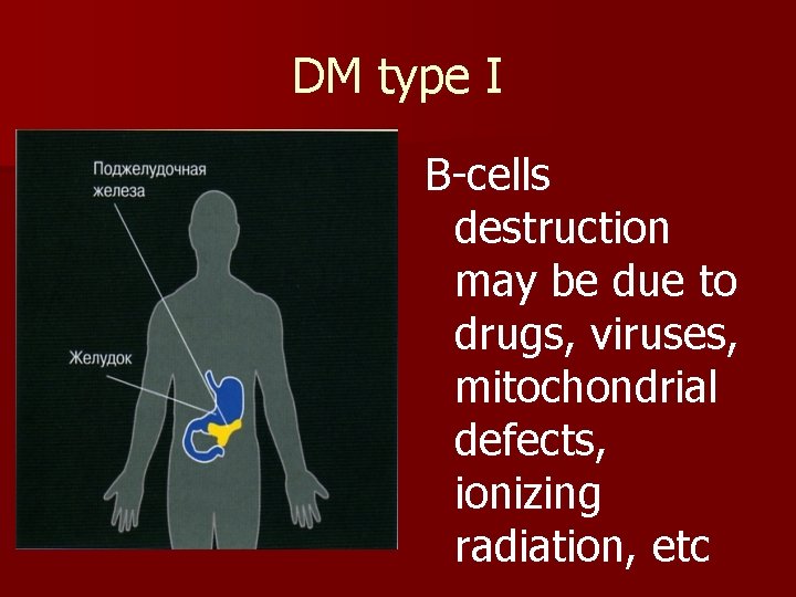 DM type I Β-cells destruction may be due to drugs, viruses, mitochondrial defects, ionizing