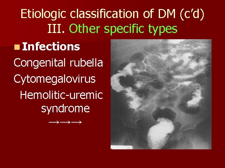 Etiologic classification of DM (c’d) III. Other specific types n Infections Congenital rubella Cytomegalovirus