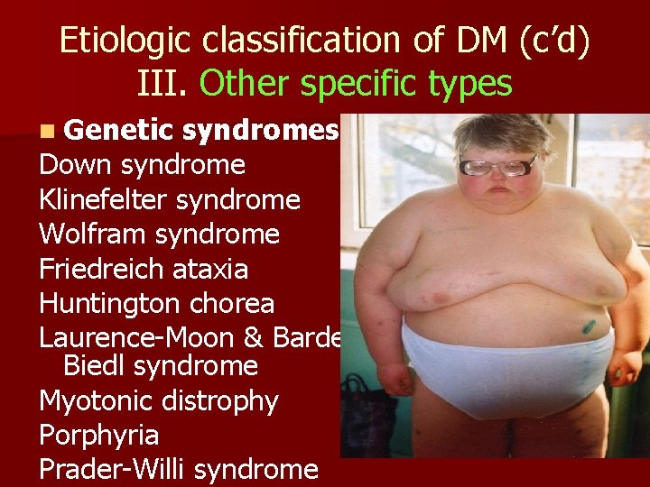 Etiologic classification of DM (c’d) III. Other specific types n Genetic syndromes Down syndrome