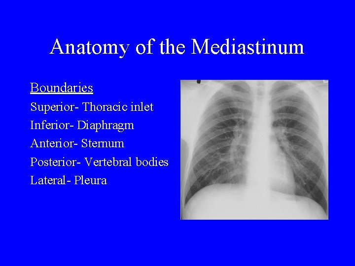Anatomy of the Mediastinum Boundaries Superior- Thoracic inlet Inferior- Diaphragm Anterior- Sternum Posterior- Vertebral