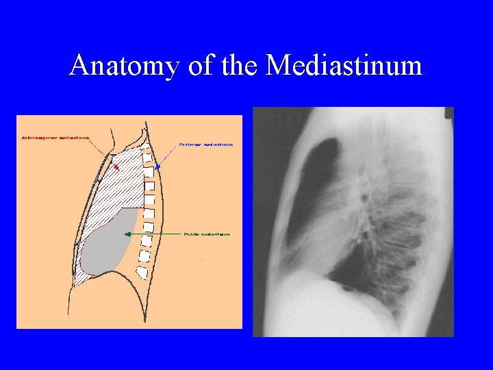 Anatomy of the Mediastinum 