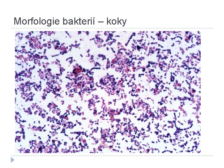 Morfologie bakterií – koky 