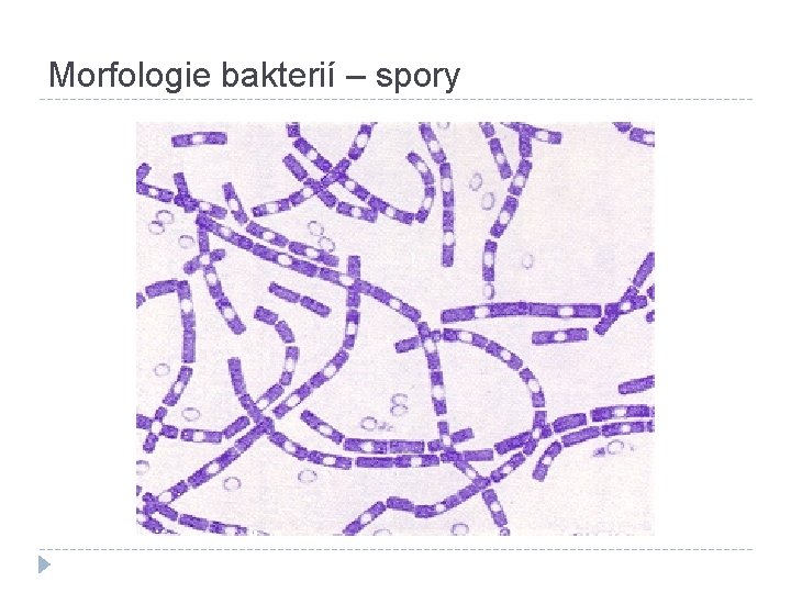 Morfologie bakterií – spory 