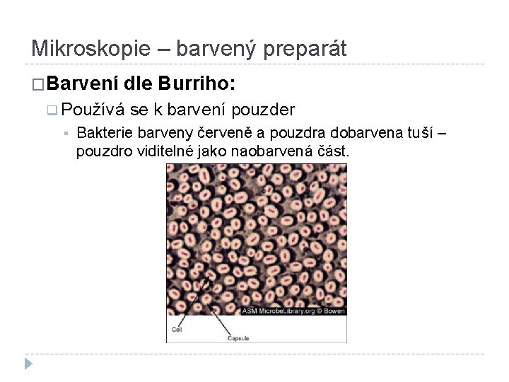 Mikroskopie – barvený preparát �Barvení dle Burriho: q Používá se k barvení pouzder §