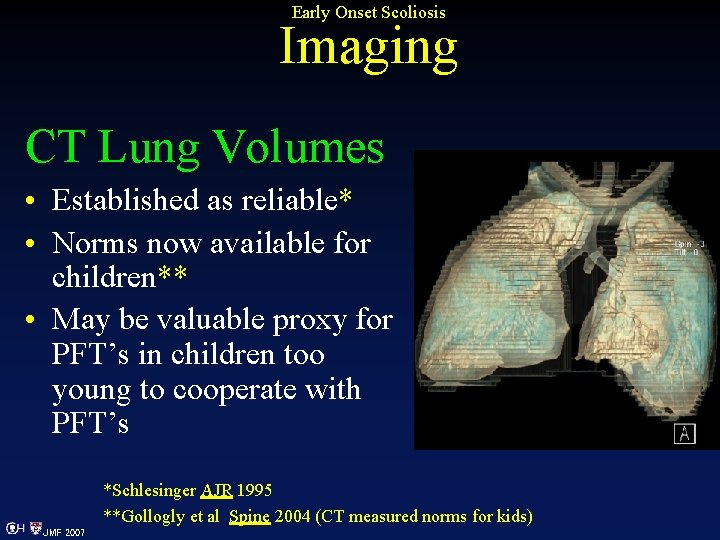 Early Onset Scoliosis Imaging CT Lung Volumes • Established as reliable* • Norms now