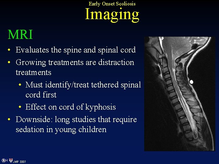 Early Onset Scoliosis Imaging MRI • Evaluates the spine and spinal cord • Growing