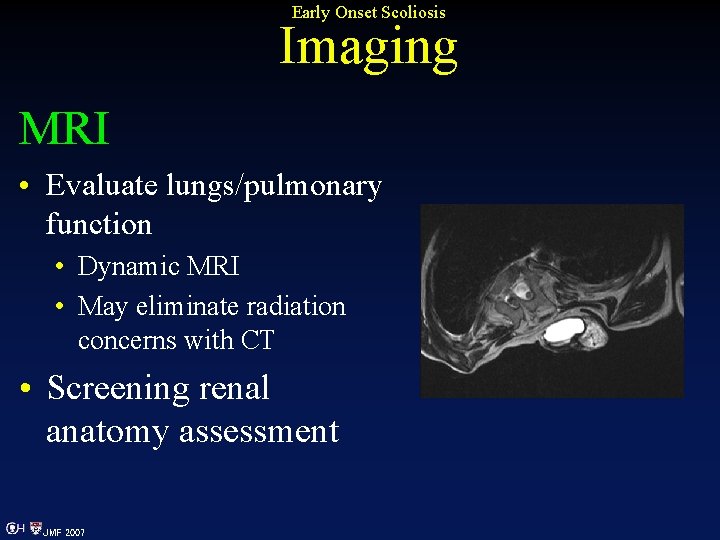 Early Onset Scoliosis Imaging MRI • Evaluate lungs/pulmonary function • Dynamic MRI • May