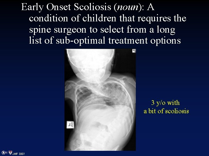 Early Onset Scoliosis (noun): A condition of children that requires the spine surgeon to