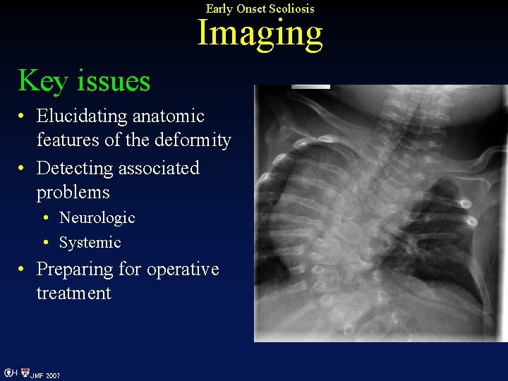 Early Onset Scoliosis Imaging Key issues • Elucidating anatomic features of the deformity •