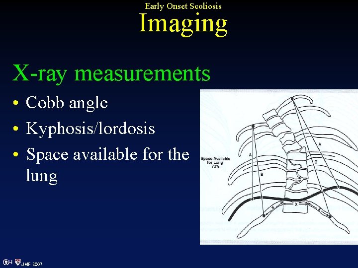 Early Onset Scoliosis Imaging X-ray measurements • Cobb angle • Kyphosis/lordosis • Space available